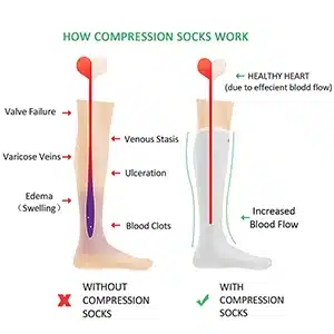 compression sleeves are great for travel, shin splints and foot and leg pain