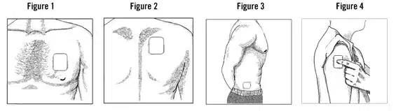 placement is key for pain patches to be effective